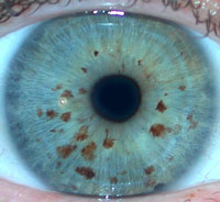 Jewel Eye